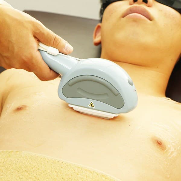 メンズ脱毛施術