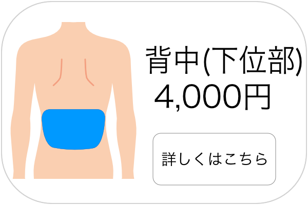 メンズ脱毛背中